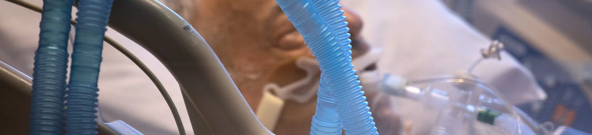 Paciente da covid-19 mantido na UTI com uso do respirador. Paciente da covid-19 mantido na UTI com uso do respirador.