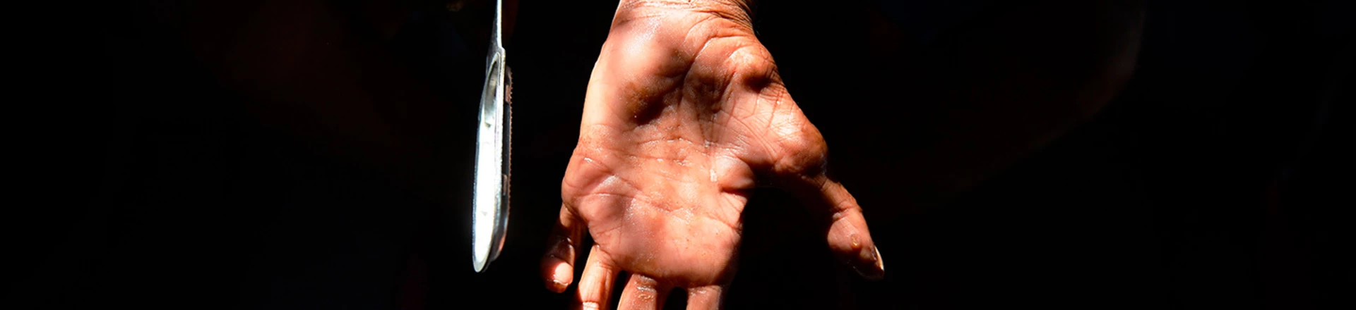 Falta de médicos em presídios agrava epidemia de hanseníase em Mato Grosso Falta de médicos em presídios agrava epidemia de hanseníase em Mato Grosso