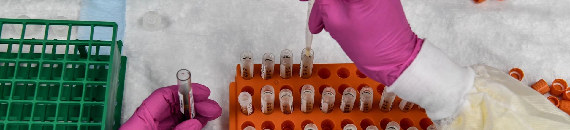 Um técnico de laboratório classifica amostras de sangue para estudos de vacinação contra covid-19 nos Research Centers of America em Hollywood, na Flórida, em 13 de agosto de 2020. Foto: Chandan Khanna/AFP via Getty Images Um técnico de laboratório classifica amostras de sangue para estudos de vacinação contra covid-19 nos Research Centers of America em Hollywood, na Flórida, em 13 de agosto de 2020. Foto: Chandan Khanna/AFP via Getty Images